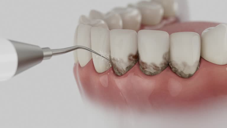 Reliable Dental contractor in Uhland, TX by Smile Center Dentistry